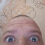 аболтус
